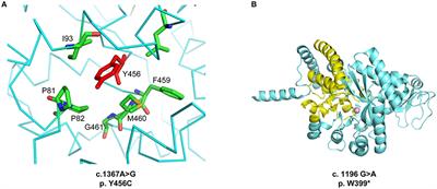 ALPS-Like Phenotype Caused by ADA2 Deficiency Rescued by Allogeneic Hematopoietic Stem Cell Transplantation